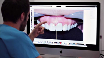 digital-orthodontics